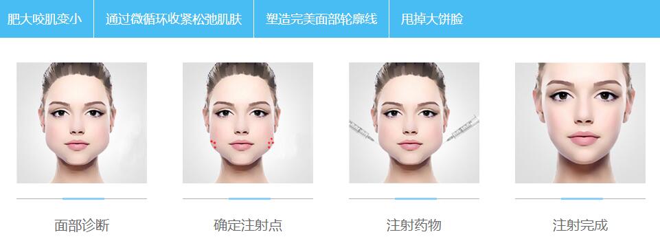 什么样的人适合注射BOTOX*?